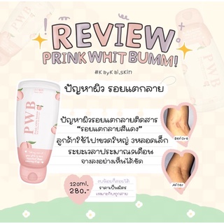 ของแท้(มีบัตรตัวแทน) PWB ครีมทาก้น ครีมลดรอยแตกลาย คุณแม่ตั้งครรภ์ใช้ได้ ลดรอยดำตามร่างกาย