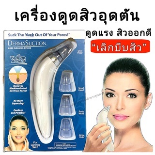 💥ของแท้!!! พร้อมส่ง 📦🎁DERMASUCTION เครื่องดูดสิวสูญญากาศ ดูดสิวเสี้ยน สิวข้างจมูก สิวอุดตัน สิวหัวดำ จุดดำจากสิวเสี้ยน