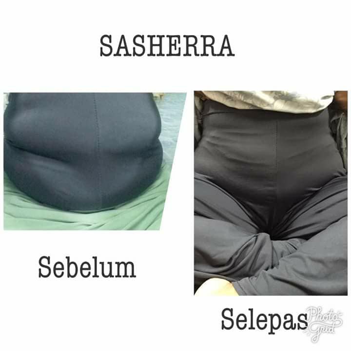 ชุดกระชับสัดส่วน sasherra zhulian