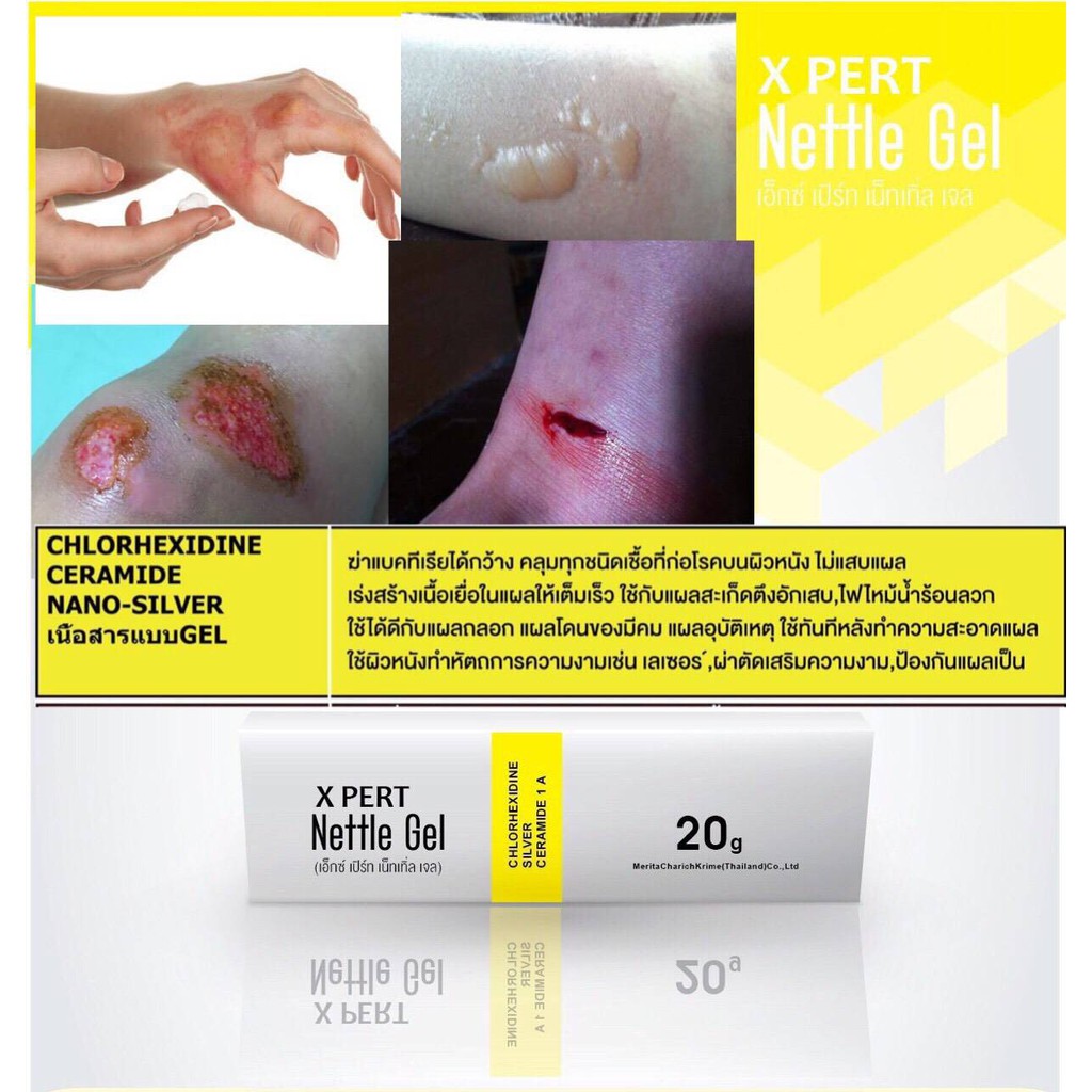 เจลทาแผลไฟไหม้ น้ำร้อนลวก X Pert Nettle Gel 20G Mck แผลผ่าตัดเสริมความงาม |  Shopee Thailand