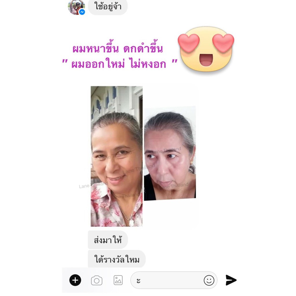My Image 37