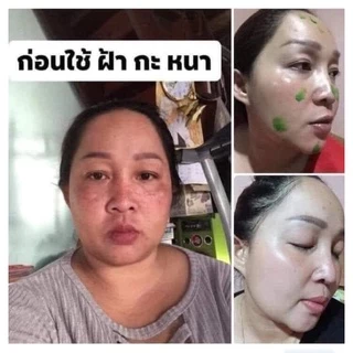 โฉมใหม่‼️ครีมไรยา ครีมริชชี่=ครีมลาน่า LANA เซรั่มมิรา Mira