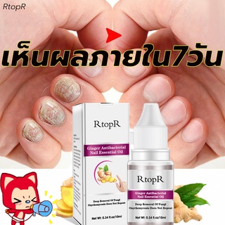 RTOPRเซรั่มรักษาเล็บ,ปรับปรุงเล็บให้แข็งแรงและมีสุขภาพดีใน(เจลดูแลเล็บ,น้ำมันบำรุงเล็บ,รักษาเชื้อราเล็บ,ซ่อมแซมเล็บ)