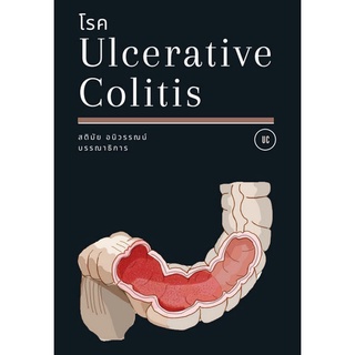 (ศูนย์หนังสือจุฬาฯ) โรค ULCERATIVE COLITIS (9786165867634)