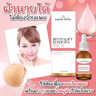 Madam secret เซรั่มมาดาม ซีเครท รักษาฝ้า กระ จุดด่างดำ