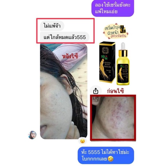 เซรั่ม จินเซง ไวท์ ขนาด 30 ml. #ส่งทุกวัน ราคา ถูกที่สุด ดีลบีเคเค แกลเลอรีภาพที่ 2