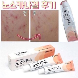 ✅พร้อมส่ง💯ของแท้ Noscarna Gel 20g เจลลดรอยแผลเป็น รอยสิว รอยดำ ครีมลบรอยแผล