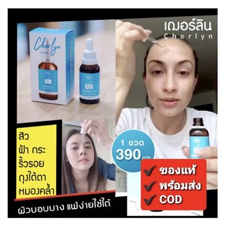 เฌอร์ลิน Cherlyn  Intensive HYA Booster White Serum เซรั่มเฌอร์ลิน เซรั่มบำรุงผิวหน้า จบสิว