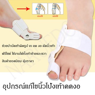 ราคาเฝือกอ่อน อุปกรณ์แก้ไขเท้าผิดรูป (สำหรับผู้มีนิ้วโป้งเท้าเอียง) คดงอ ดัดเท้า เท้าเก เท้าเอียง ฟรีไซร์ พร้อมส่ง คุ้มราคา