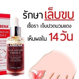 Lanbena ยา เซรั่ม รักษาเล็บขบ/เชื้อรา หายขาด❌แถมตะไบ