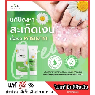 ของแท้ 100% *** นัชชา ณัชชา โบเต้ อัลตร้ายู Natcha Beaute Ultra U ปัญหาผิวลอก ภูมิแพ้ผิวหนัง ผดผื่นคัน ส้นเท้าแตก สะเก็ด