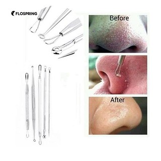 ที่มีประโยชน์ 5 ชิ้นผู้หญิง Professional Blackheads Remover สารสกัดจาก Acne Comedone Facial Tool