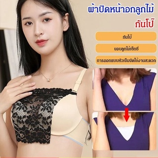 ผ้าปิดหน้าอกลูกไม้ กันโป๊