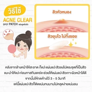 CHER Acne Clear Spot Patch เฌอ แผ่นดูดซับสิว