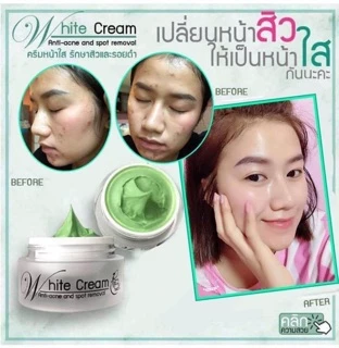 White Cream anti-acne ( บีมิราเคิลครีม) ครีมหน้าใส ครีมลดสิว•ขนาดทดลอง5กรัม•