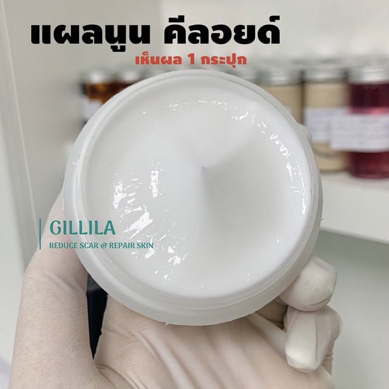 กระปุกใหญ่300g. GILLILA’🔥 เข้มข้นx5‼️ (สำหรับผิวกาย) ลบรอยแผลเป็นนูน,คีลอยด์ แผลผ่าตัด,รอยเย็บ,ศัลยกรรม 🔥
