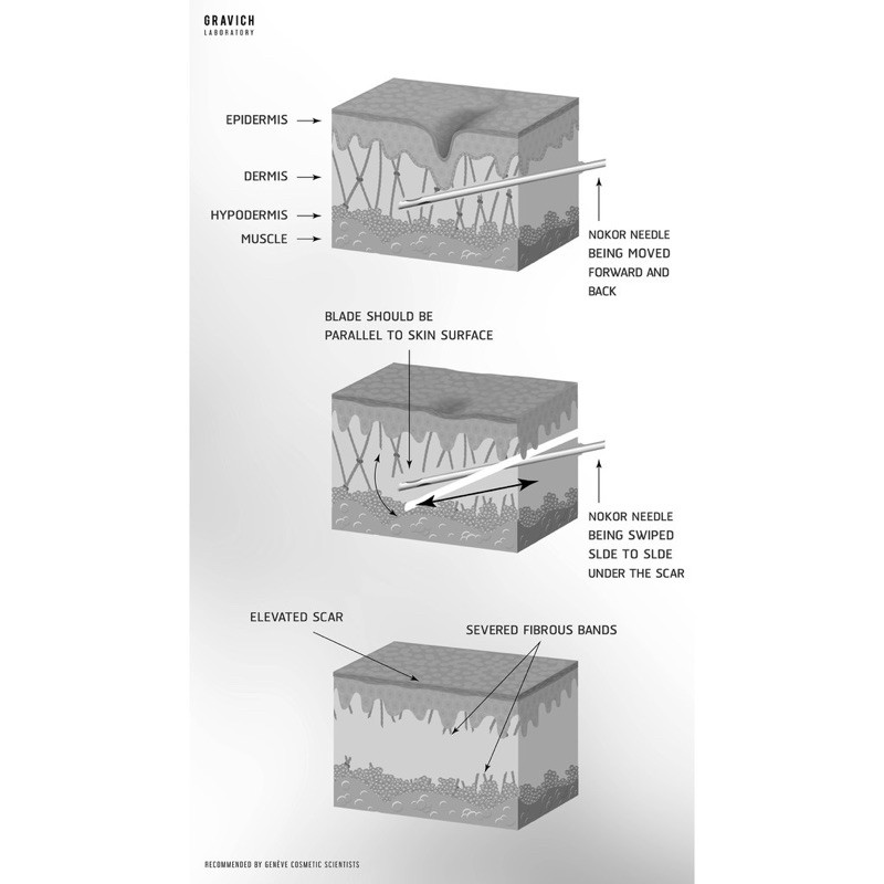 gravich blue peptide