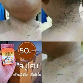 💥สบู่โสมมริการะเบิดขี้ใคลx2 💜สั่ง3ชิ้น/145.- 📌ยิ่งซื้อยิ่งลด  คอดำ  สิว จุดด่างดำ ผดผื่นคัน กลิ่นตัว  ผิวหมองคล้ำ