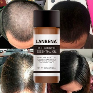 ac LanBeNa Hair Growth Essential Oilน้ำยาปลูกผม ของแท้100% (มีบริการเก็บเงินปลายทาง)