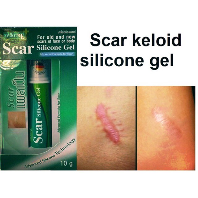 Smooth E Scar Silicone Gel สมูทอี สกา ซิลิคอน 10 G ช่วยให้แผลเป็นนิ่มขึ้นและเรียบลง ลดรอยแดงหรือดำ และ อาการคันของแผล — صورة 2