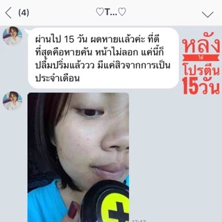 โปรตีนบัวหิมะ แก้ผดผื่น แก้รอยแตกลาย ใช้ได้ตั้งแต่เด็ก3ขวบ