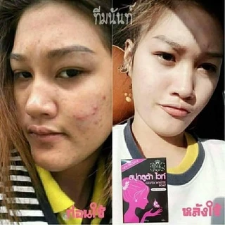 🍊สบู่กลูต้าไวท์ BMK SKINCARE 🍊 ช่วยผลัดเซลล์ผิว เพิ่มความใส✨