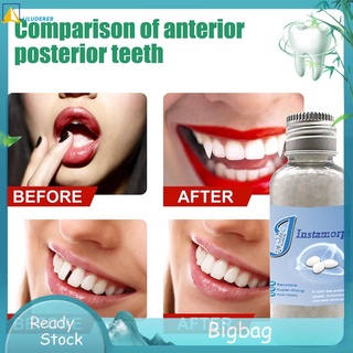 Liluderer ทันตกรรมฟื้นฟูชั่วคราวฟันชุดซ่อมกาวฟันปลอมฟันและช่องว่าง FalseTeeth แข็งกาวฟันปลอมกาวพลาสติกไวท์เทนนิ่งฟันปลอมเนียร์ Moldable Liluderer