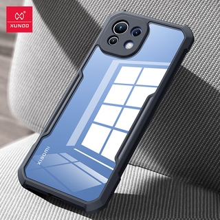 XUNDD เคสโทรศัพท์กันกระแทกสําหรับ Xiaomi Mi 11 Lite 4 G 5 G