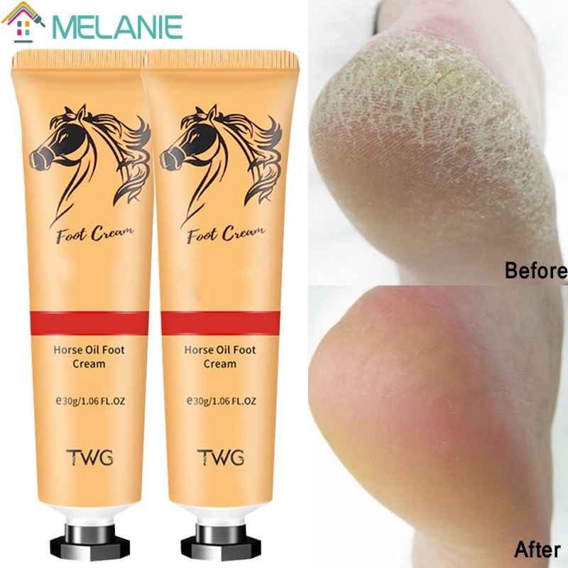 Chapped Feet Moisturizing Foot Cream/Cracked Feet Skin Care Cream/ Outdoor Travel Portable Foot Care