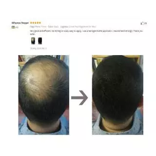 SEVICH Hair Fiber 40g ผงไฟเบอร์ เพิ่มเส้นผม สำหรับ หัวล้าน ผมบาง เสริมความมั่นใจ