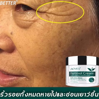 BETTER ครีมลบริ้วรอย 50ml ส่วนผสมต่อต้านริ้วรอย ให้ความชุ่มชื้น กกระชับผิว ครีมช่วยยกกระชับ ครีมริ้วรอย ครีมลดริ้วรอย