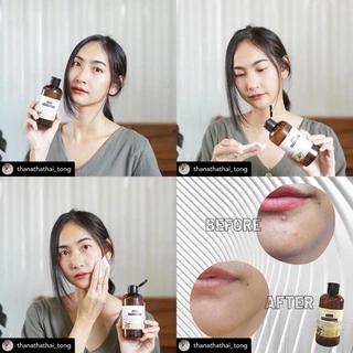 Minaki Pure-ri Premium Cleansing Essence เพียวริ คลีนซิ่ง 400ML ลดสิว ผิวกระจก