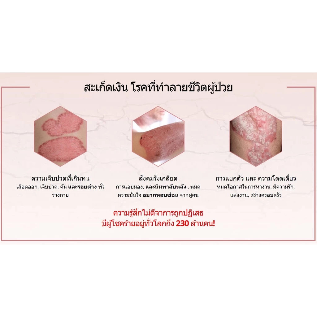 ELSIE ผลิตภัณฑ์ฟื้นฟูสุขภาพผิวหนัง และบรรเทาสะเก็ดเงิน - เซ็ต 3 กล่อง thumbnail 7
