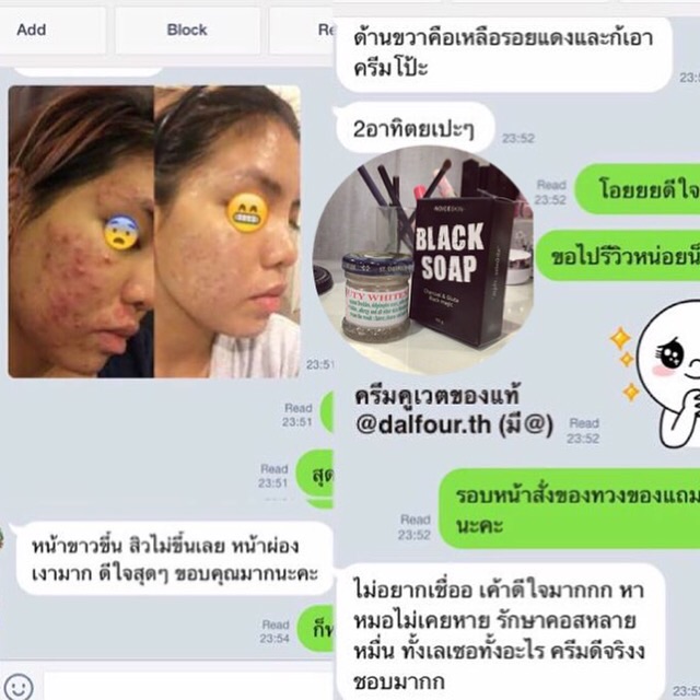 ส่งไว สบู่ถ่าน ชาร์โคล ผสมกลูต้า​คอลลาเจน​ ⚫ ราคา ถูกที่สุด ดีลบีเคเค แกลเลอรีภาพที่ 8
