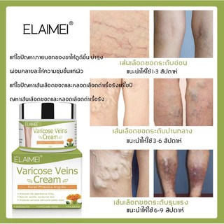 Varicose Veins Cream สำหรับทาเส้นเลือดขอด เป็นยาทาเส้นเลือดขอดที่ช่วยส่งเสริมการไหลเวียนเลือดบรรเทาอาการบวมชา 50 กรัม