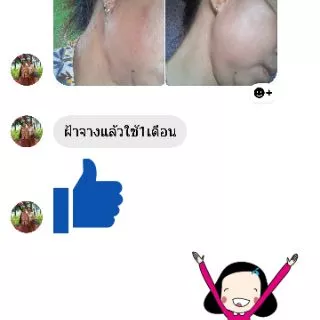 ⚡ถูกที่สุด⚡ขายดีที่สุด ของแท้ส่งตรงจากบริษัท #ครีมโยนิเซ่​ Yonise 🎁มีของแถมทุกกล่อง