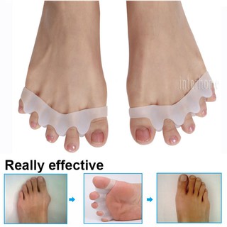 อุปกรณ์ดูแลเท้า Hallux Valgus Corrector 5 นิ้ว