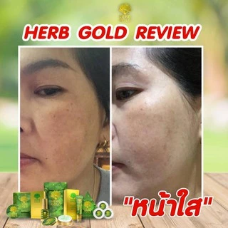 HERB Gold ครีมเฮิร์บ โกลด์ ชุด ครีม 30กรัม+ สบู่ 50 กรัม