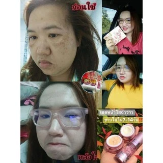 ครีมสโนไวท์ของแท้100%1ชุดประกอบด้วย4ชิ้น💐(เซรั่ม,ครีมกลางวัน,ครีมกลางคืน,สบู่)