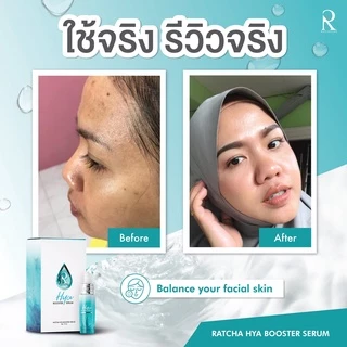 ไฮยาบูสเตอร์ เซรั่ม เซรั่มน้องฉัตร เซรั่มไฮยาน้องฉัตร Ratcha Hya Booster Serum 15ml.