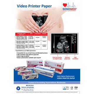 กระดาษปริ้นอันตราซาวด์ทางการแพทย์ SONOMED  Thermal paper for Ultrasound (ultrasound printer paper)