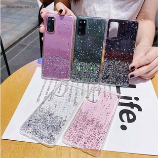 Xiaomi Redmi Note 10 10S 9T 9S 9 Pro 8 7 6 5 4 4X สำหรับ Case Silver Foil เคส เคสโทรศัพท์ เคสมือถือ เคสนิ่ม เคสซิลิโคน