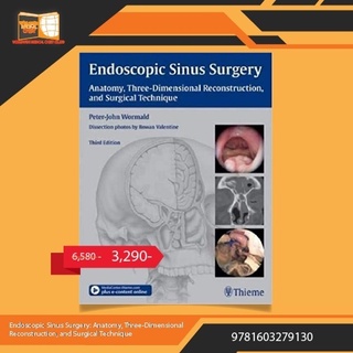 Endoscopic Sinus Surgery: Anatomy, Three-Dimensional Reconstruction, and Surgical Technique