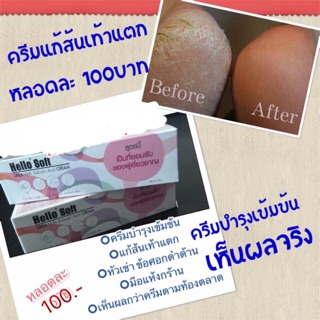 👢ครีมทาส้นเท้าแตก ครีมเท้านุ่ม นุ๊ม