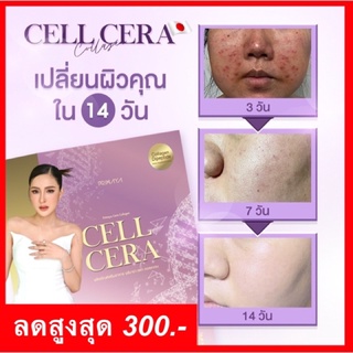 ลดสูงสุด300 ทักแชทค่ะ💕 Cell Cera ลดสิว ฝ้ากระ ริ้วรอยเหี่ยวย่น ปรับขาวใส มีออร่า / Primaya พรีมายา เซลเซล่า CellCera