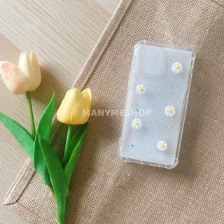 เคส iPhone handmade กลิตเตอร์ลายดอกเดซี่  🌼ลายขายดีอันดับ 1 ของร้าน🌼 เป็นสินค้าสั่งทำ