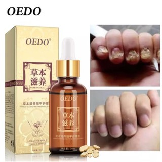 *ส่งจากไทย*OEDO น้ำมันบำรุงเล็บ ต้านเชื้อแบคทีเรีย รักษาเล็บ ซ่อมเซมเล็บ HERBAL NOURISHING FINGERNAIL ESSENCE รหัส 6038