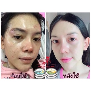 ครีมเอวา ครีมหน้าใส_ลดสิว_ฝ้ากระ ของแท้100%มีบัตรตัวแทน