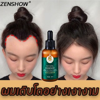 เซรั่มขิงบำรุงผม 30ml สารสกัดจากขิงป้องกันผมร่วง   ครีมนวดผมขิง   เซรั่มลดผมร่วง ผลิตภัณฑ์ป้องกันผมร่วง แฮร์โทนิค