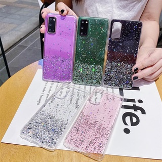 Oppo A93 / A53 / A92 / A52 / A31 2020 / A9 2020 / A5 2020 กลิตเตอร์ วิบวับ เคสใส ซิลิโคนนิ่ม เคสโทรศัพท์ TPU